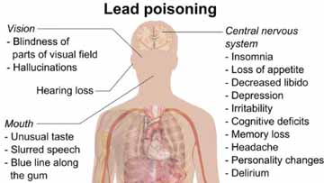 Lead poisoning testsing